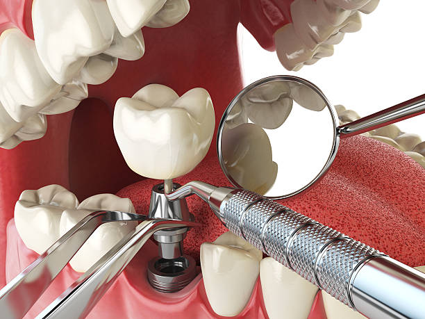 Best Emergency Orthodontic Repairs in Chattanoo Valley, GA
