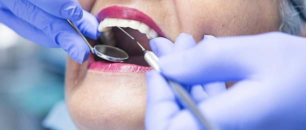 Best Emergency Care for Gum Disease in Chattanoo Valley, GA