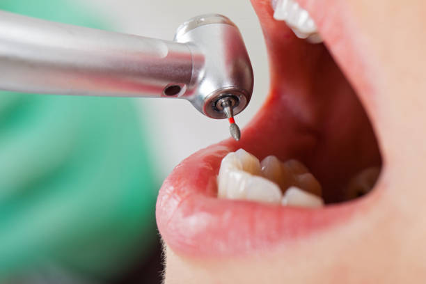 Best Broken or Chipped Tooth Repair in Chattanoo Valley, GA